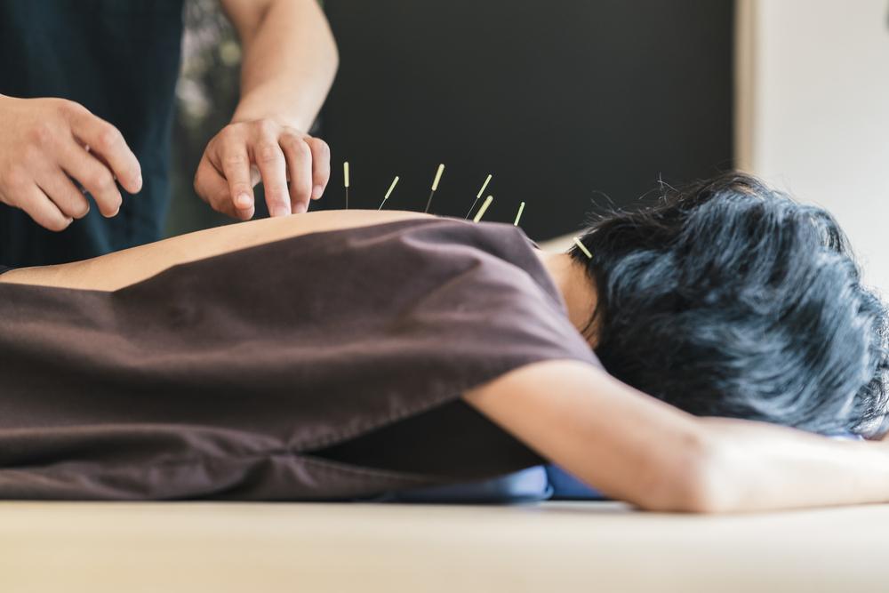 Cuáles son los diferentes tipos de agujas de acupuntura?  John Hopkins  College, Carreras y cursos cortos de éxito